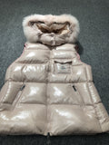 Moncler Fur-Trim Hooded Down Vest — hero